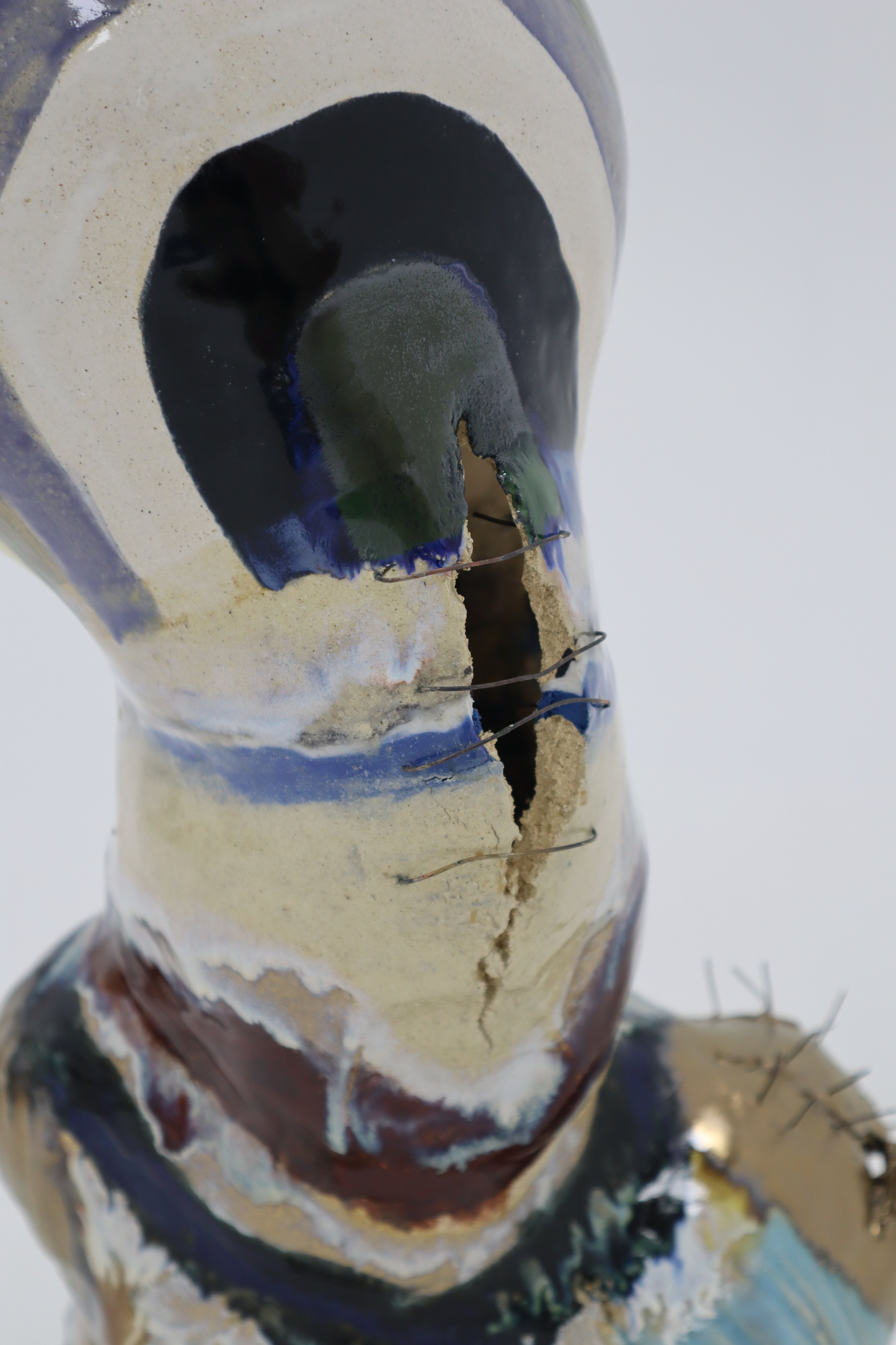 Self VI detail — neck fracture and wire joins